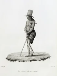 Guam: A Man with Elephantiasis, from 
